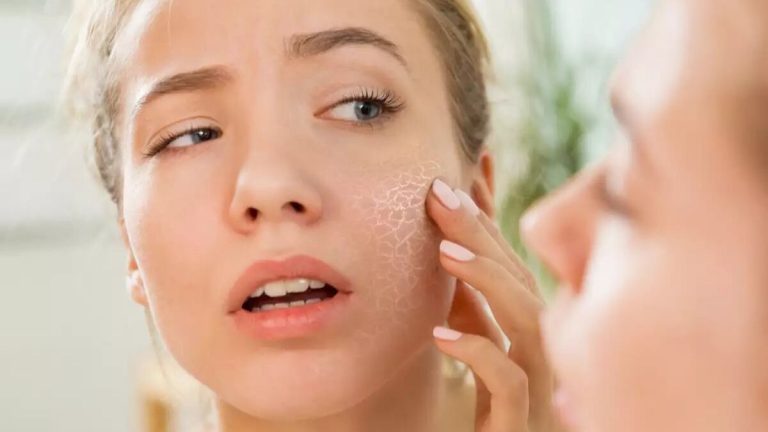 زنی در حال تلاش برای بررسی پوست خشک خود در آینه با نگرانی